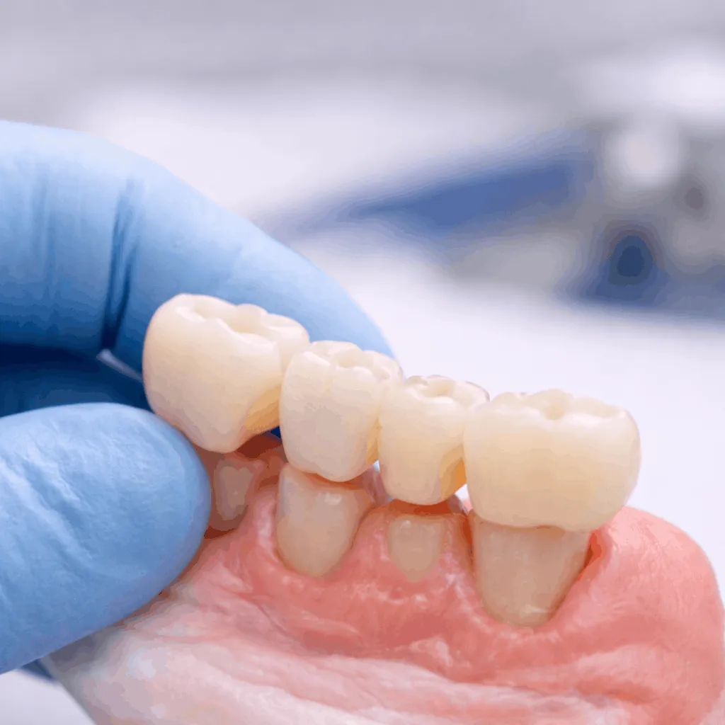 Treatment Process – What to Expect