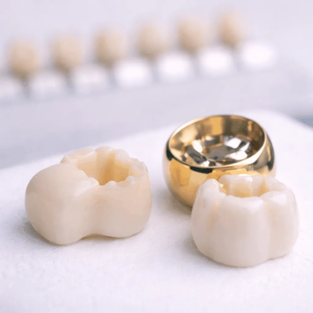 Dental Crowns & Bridges – What They Are and When You Need Them