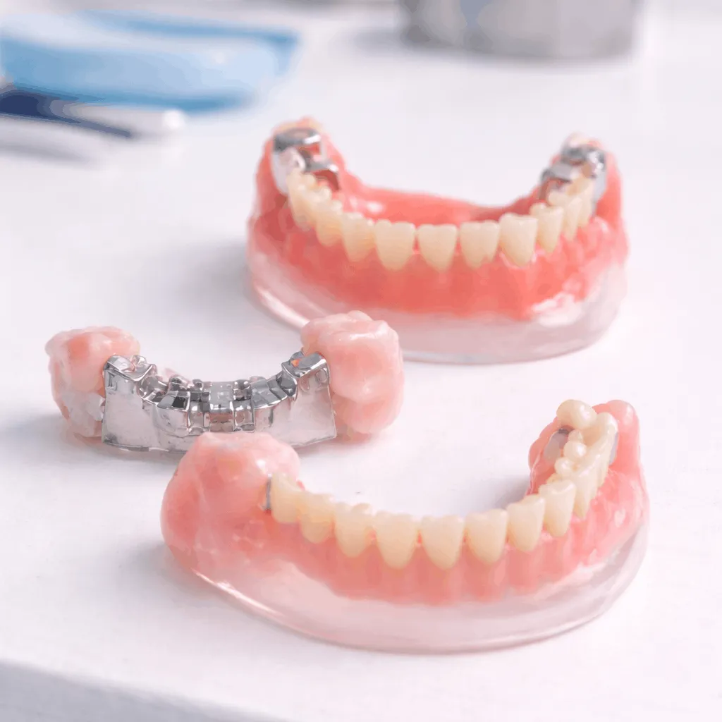 Dentures in Amsterdam – Full, Partial & Implant-Supported Options